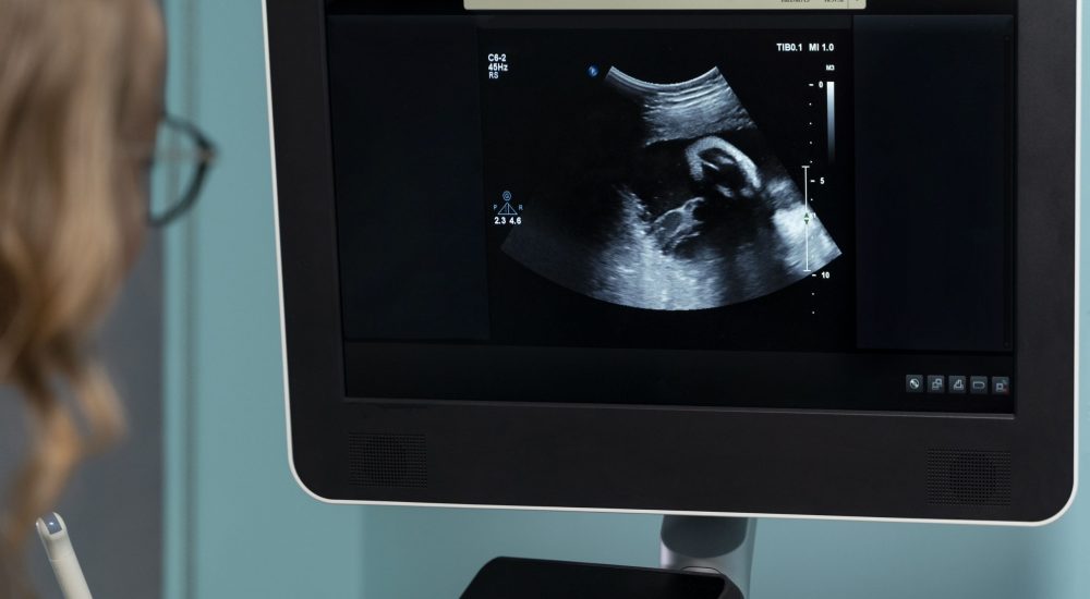 gynecologist-performing-ultrasound-consultation